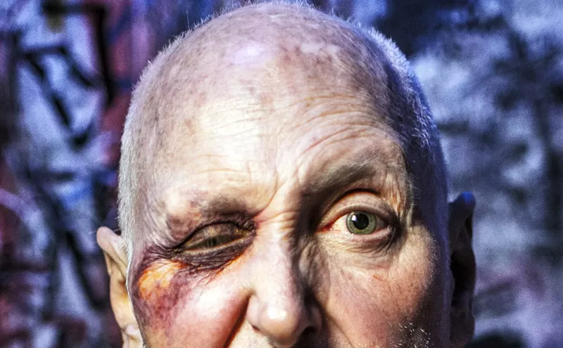 Image: Bruised but Not Defeated: The IRS Wants Poet Rawlins Gilliland to Pay $40,000. His Followers Aren’t Having It.