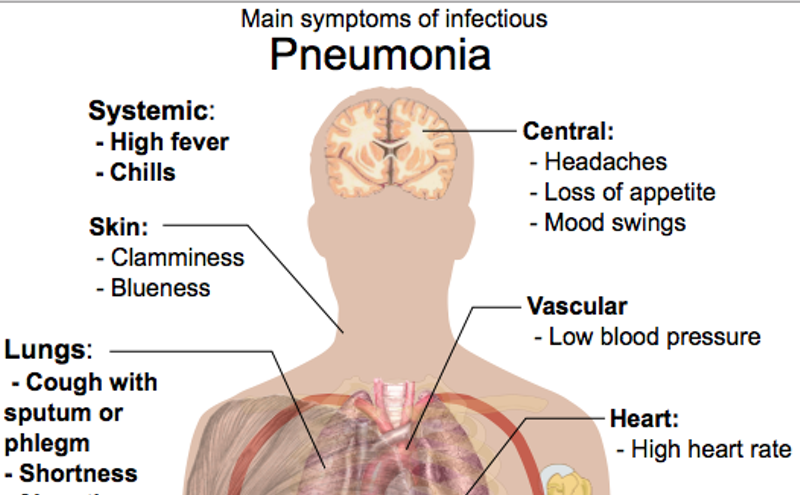 Image: Dallas County Officials: The Flu Is Stalking DFW