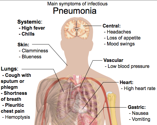 The flu virus the the main cause of pneumonia. So cover your face when you sneeze.
