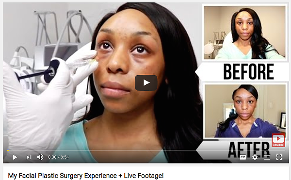 We Asked a Fort Worth Woman Why She's Livestreaming Her Breast Augmentation Surgery